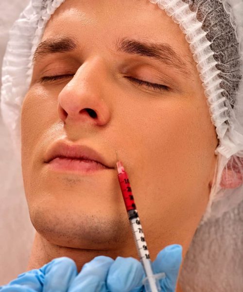 Dermal Fillers Man in Riverdale, UT | Gladiator Health MD Riverdale UT