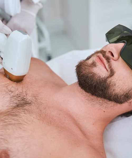 Laser chest hair removal in Riverdale, UT | Gladiator Health MD Riverdale UT